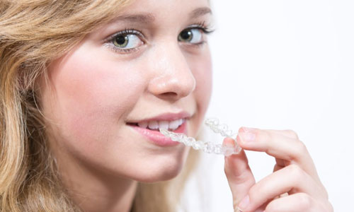 Invisalign<sup></noscript>®</sup> Teen